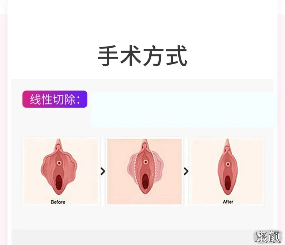 src=http%3A%2F%2Fimg.miyanlife.com%2Fmnt%2Ftimg%2F210101%2F164334E48-1.jpg&refer=http%3A%2F%2Fimg.miyanlife.webp