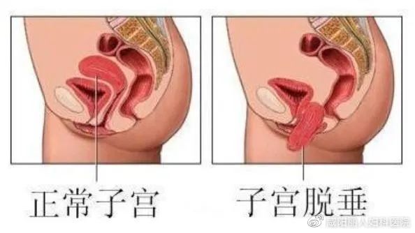 1f8f8302e6ed2b0dc8486aeed76aa5b1_cea13f70ly4hebrfhuazvj20gi09agm3.jpg