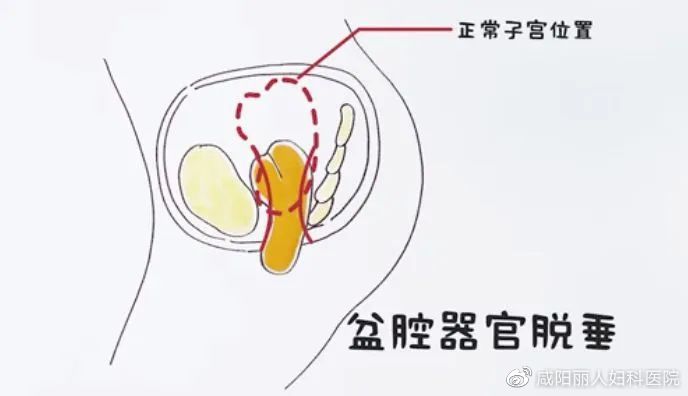 4ca0b40f60e1686b91bb09d4d6add463_cea13f70ly4hebrfig6w3j20j40b03yt.jpg