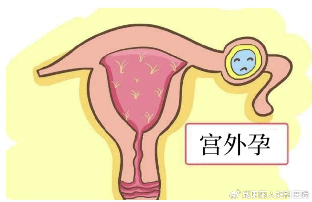 a5c0b7325f6575c98e648053e513a9c7_cea13f70ly4hx1kknrlswj20u00jggng.jpg