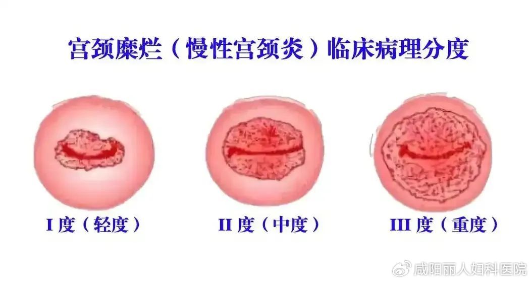 7cf71c5c007c24f4f919780ab21e2e6d_cea13f70ly4i184xmiym4j20ta0fkab7.jpg