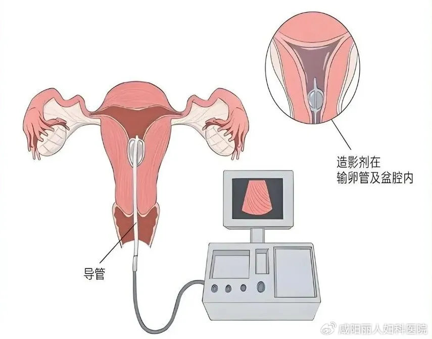 5baee7afe41a9c2f725d72beb43e693e_cea13f70ly4i1dxv5ui0bj20nr0iodhc.jpg