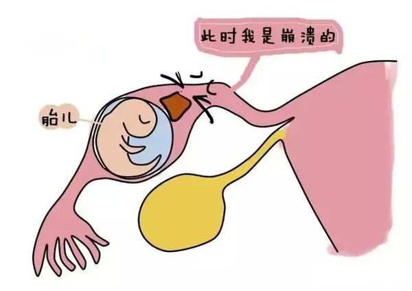 ae844556241ee6c3d469d56e11153e28_640_wx_fmt=jpeg&wxfrom=10005&wx_lazy=1&wx_co=1&tp=webp.webp