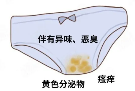 a1201a098bbbf371f18b627592624ed2_cea13f70ly4i4ec52b8qmj20cn08ljtw.jpg