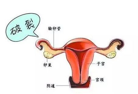 咸阳,停经,痛经,阴道出血,月经不规律,月经不调,咸阳治疗月经不规律哪里好,咸阳治疗月经不调